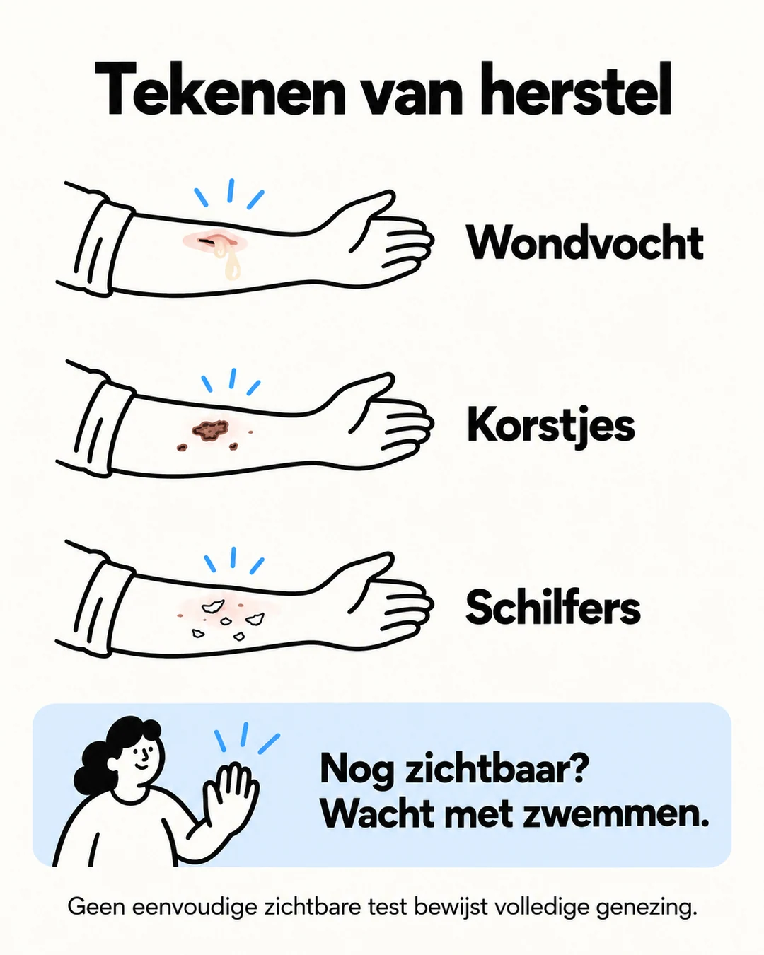 Infographic met wondvocht, korstjes en schilfers als redenen om te wachten met zwemmen.