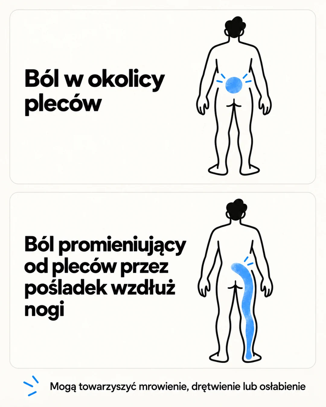 Porównanie bólu ograniczonego do pleców z bólem promieniującym przez pośladek i nogę
